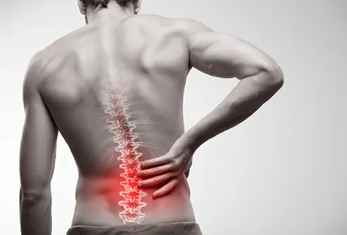 Low Back Pain (With or Without Sciatica)