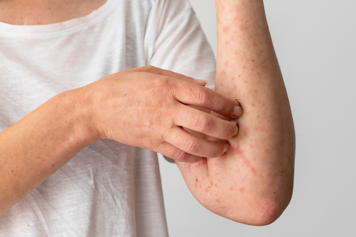 Do You Need a Rash Diagnosis or Can It Wait?